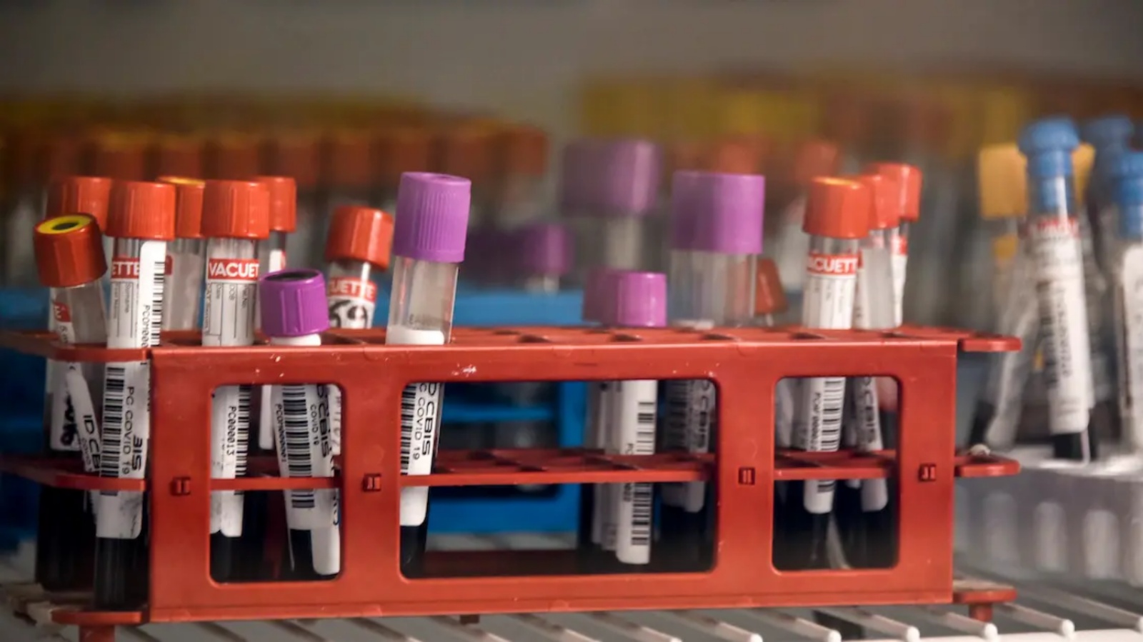 فحوصات الدم أظهرت قطعًا بلاستيكية مجهرية ونانوية ذات حواف خشنة في اللويحة المبطنة للأوعية الدموية