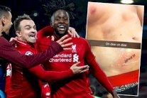 مشجع ليفربول يكتب اسم أوريجي على جسده