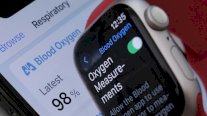 أبل تنتزع قراراً بإعادة بيع ساعاتها الذكية في الولايات المتحدة