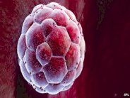 تقنية الاستنساخ لاستحداث أول خلايا جذعية من البشرة