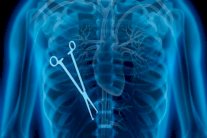 أخطاء طبية قتلت 19 ألف ألماني في 2013