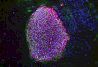 علماء يستنسخون خلايا جذعية من سيدة مصابة بالسكري