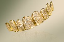 أغلى ابتسامة في العالم من الذهب والماس مصنوعة في دبي