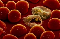 عشرة طفيليات تنتقل عبرا لغذاء لتهدد حياتنا 