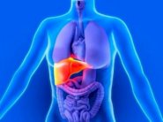 دواء للملاريا يحمي من سرطان الكبد