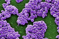 سموم الجمرة الخبيثة لقتل الخلايا السرطانية