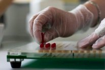 العلاجات المناعية تشكل نقلة نوعية في علاج السرطان