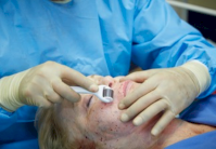 عيادة للطب التجميلي بلندن تعيد شباب البشرة دون جراحة