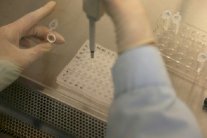 بكتيريا معوية تنتج بروتينات تؤثر على الشعور بالشبع 