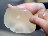 تجدد المخاوف من تداعيات عمليات زرع الثدي في فرنسا