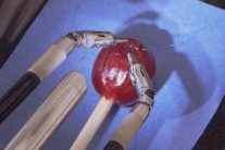 روبوت أفعواني يستأصل أورام الدماغ