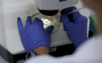 العازبات اكثر عرضة لمرض اللوكيميا