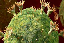 فيروس الإيدز 