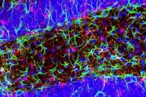 منع التهاب الدماغ 