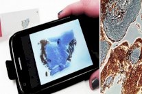 تقنية للتعرف على الخلايا السرطانية أثناء العملية الجراحية