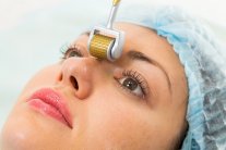 تقنية الميزو لعلاج مشكلات البشرة واستعادة نضارتها