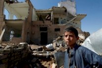 سوء التغذية والأمراض يقتلان طفلا يمنيا كل عشر دقائق