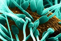 إنتاج حيوانات منوية في المعمل