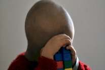 علاج واعد يقضي على السرطان خلال عامين 