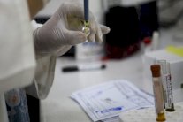 مصل مضاد لفيروس زيكا 