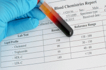 الكولسترول المفيد يكون ضارًا أحيانًا بالقلب