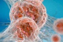 دراسة: عينات من مرضى توفوا بالسرطان تبعث الأمل في علاجه