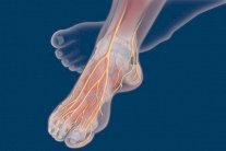 بتر أطراف مرضى السكري لا لزوم طبيًا له