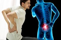 علماء يبتكرون علاجًا ثوريًا لآلام الظهر