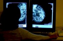 فحص جديد للدم يكشف مكان السرطان ونوعه