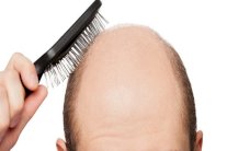 ويبقى الرجل الأصلع أقل جاذبية ونجاحاً