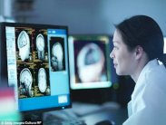 الذكاء الاصطناعي ينتصر على الأطباء في سرعة كشف الزهايمر