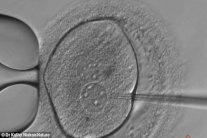 هل نشرف على حلّ مشكلات الخصوبة؟