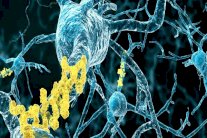 علماء ألمان يبتكرون علاجاً يوقف تقدم الزهايمر