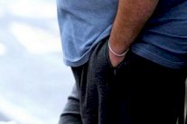 اختبار يجنب العلاج الكيميائي لمرضى سرطان البروستاتا