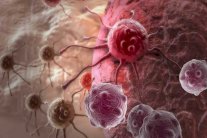 التوتر اليومي يرفع خطر الإصابة بالسرطان