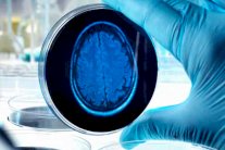 حقنة لوقف مرض الزهايمر في غضون عشر سنوات