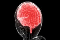 كافحوا الزهايمر ... بالضوء والصوت!