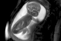 تقنية جديدة لتصوير قلوب الأجنة تساعد في إنقاذ حياة الأطفال فور الولادة