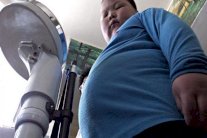 السمنة تؤثر على بنية الدماغ !