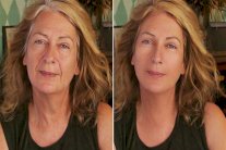 التجميل الرقمي بديل من الجراحة... فيديو