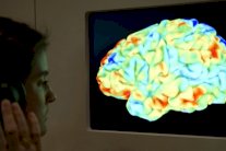 طريق جديد لعلاج مرض الزهايمر