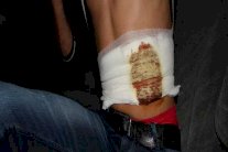 لاجئون سوريون يبيعون أعضاءهم في بيروت