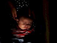 بدء حملة لتلقيح 23 مليون طفل بعد الكشف عن اصابات شلل اطفال في سوريا