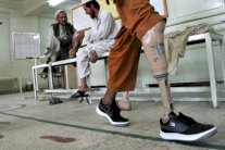 العفو الدولية تحض اليمن على الامتناع عن بتر أطراف مدان بالسرقة 