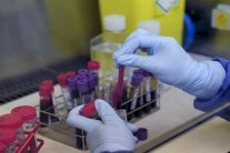 هيومن رايتس ووتش تندد بالتمييز ضد حاملي فيروس الايدز في اليمن