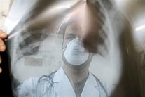 ظهور عدة حالات بمرض انفلونزا الخنازير في قطاع غزة