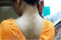 أمنيستي تفجر قنبلة 