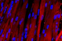 علماء يبتكرون أول عضلات بشرية اصطناعية 