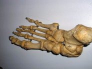 قريبًا... إنبات طرف بشري كامل بطابعة ثلاثية الأبعاد