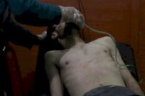 منظمة حظر الاسلحة قلقة لانباء الهجوم بالغاز في سوريا